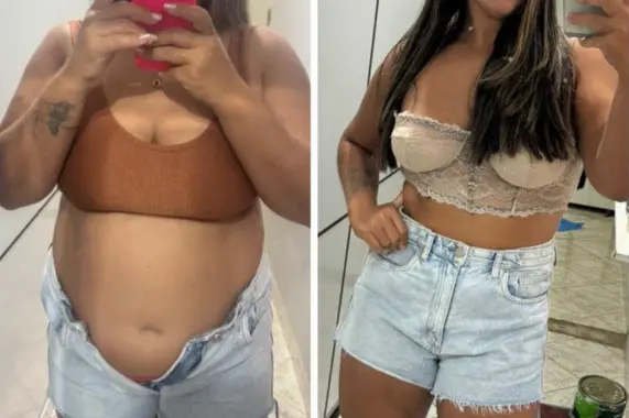 Tratamento para emagrecimento