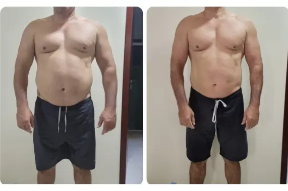 Tratamento Mensal para Emagrecer